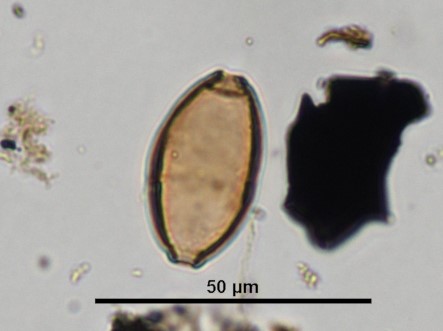 Trichuris